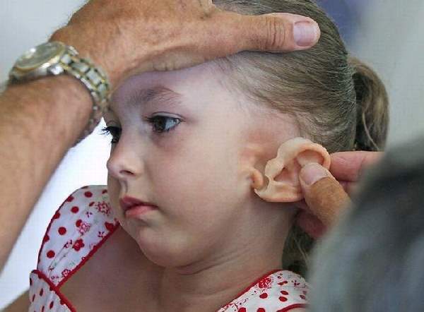 Shangrala's Girl Gets New Ear