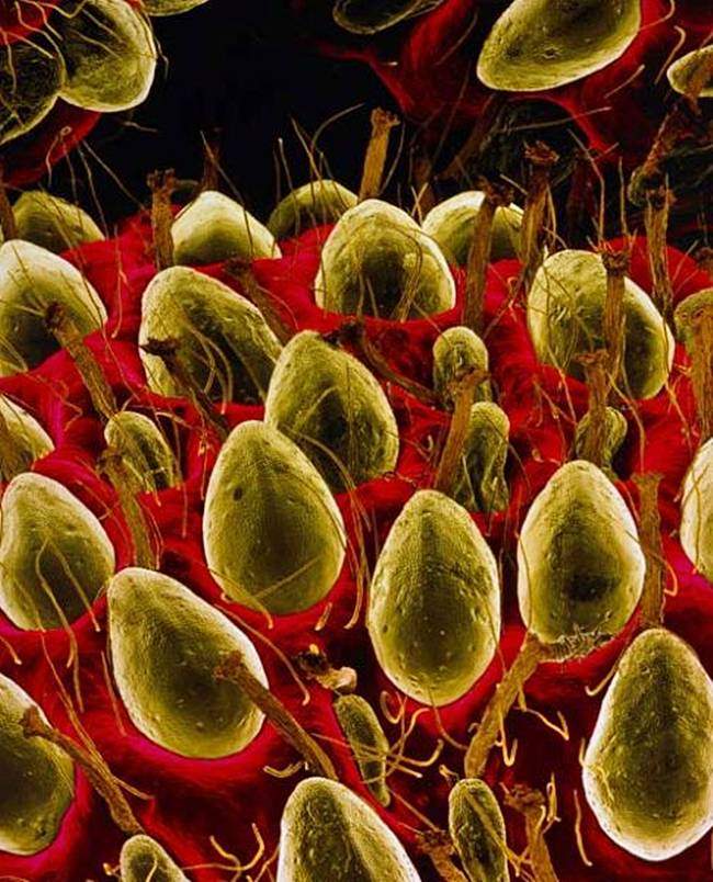 Microscopic