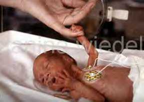 Shangrala's Miracle Baby