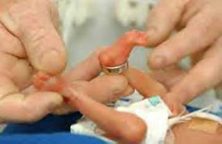 Shangrala's Miracle Baby